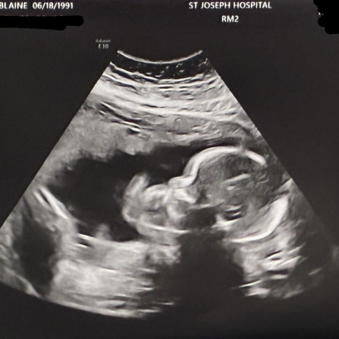 Photo shared by Blaine for their Babylist baby registry.