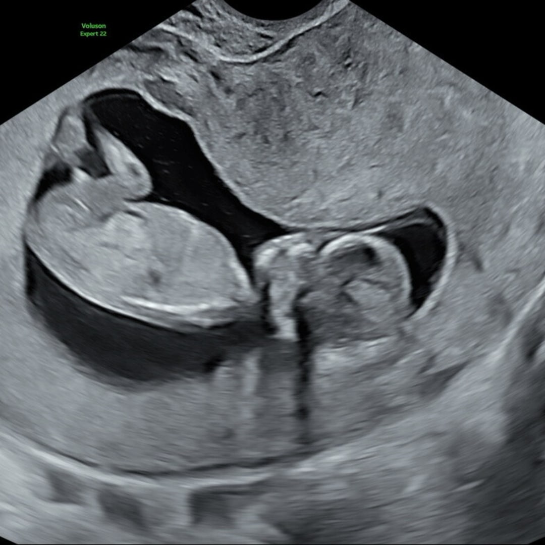 Photo shared by Jaira for their Babylist baby registry.