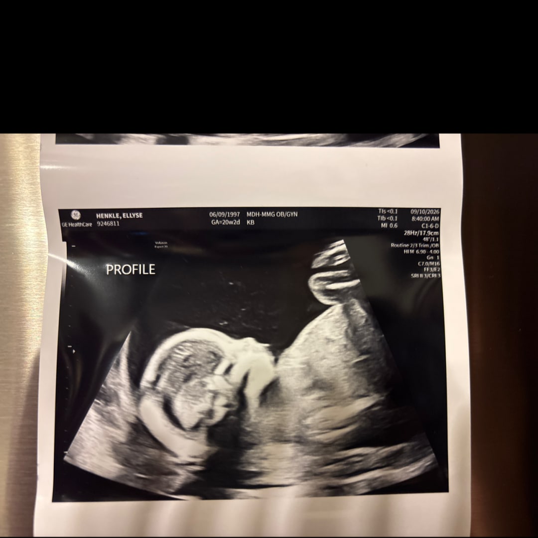 Photo shared by Ellyse for their Babylist baby registry.