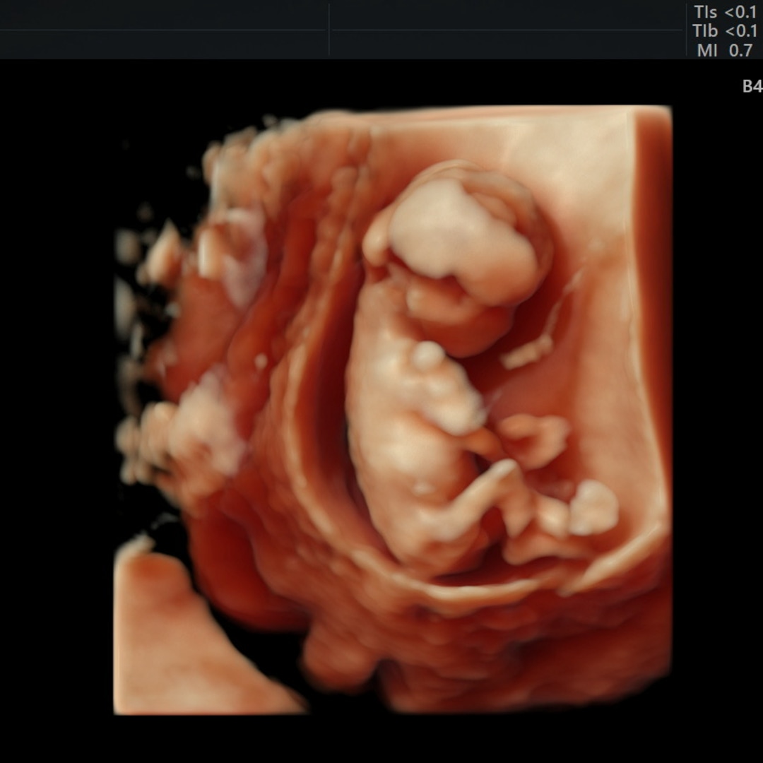 Photo shared by Yaromie for their Babylist baby registry.