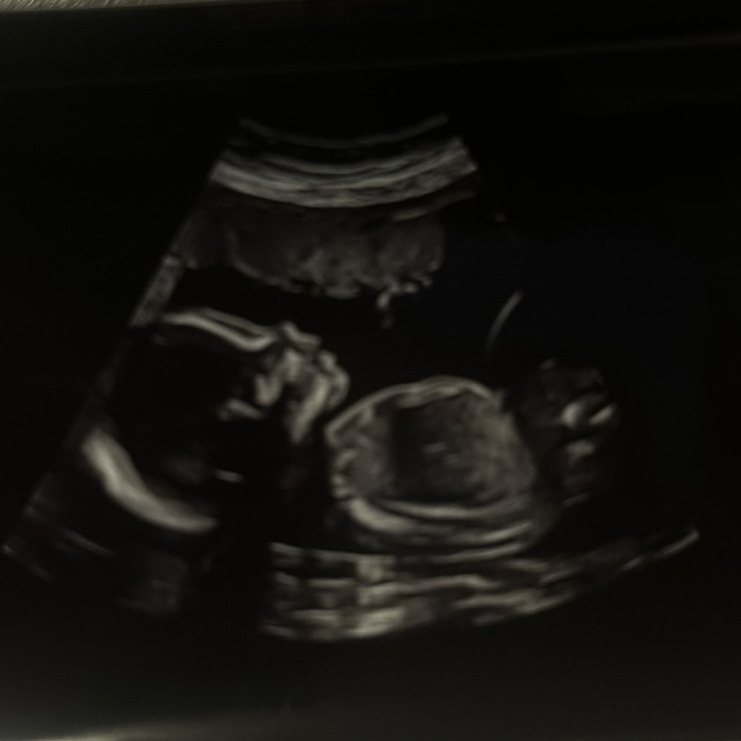 Photo shared by Yadira for their Babylist baby registry.