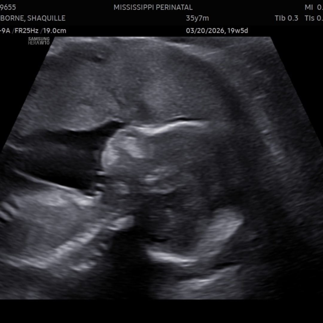 Photo shared by Shaquille for their Babylist baby registry.