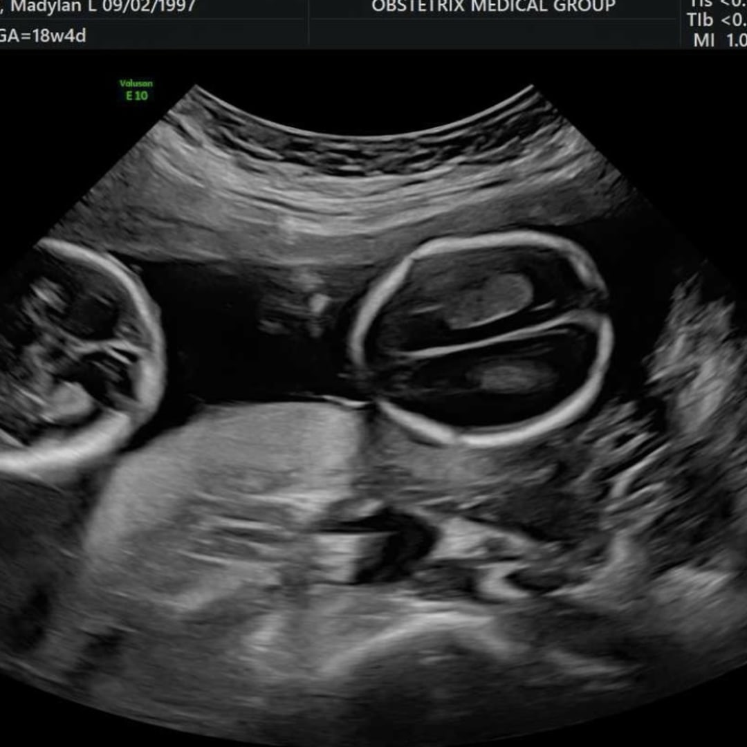 Photo shared by Mady for their Babylist baby registry.