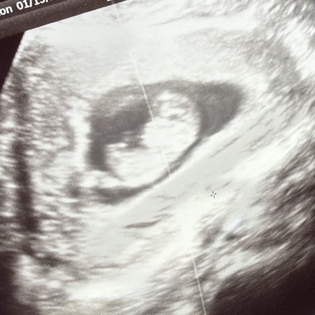 Photo shared by Creighton for their Babylist baby registry.