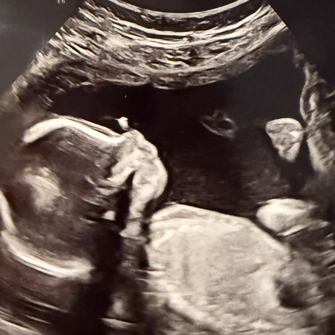 Photo shared by Shannon for their Babylist baby registry.