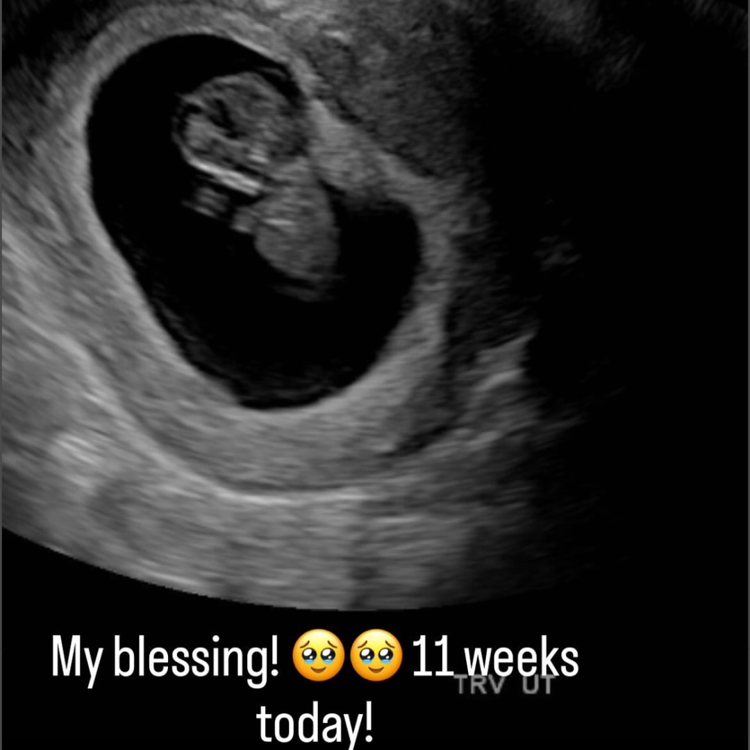 Photo shared by Carlescia for their Babylist baby registry.