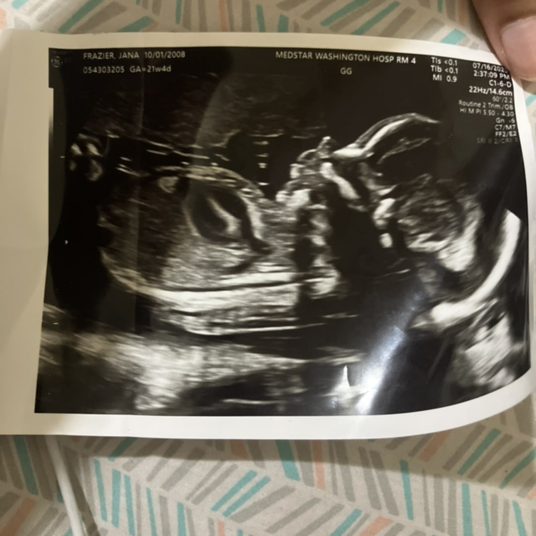 Photo shared by Jana for their Babylist baby registry.