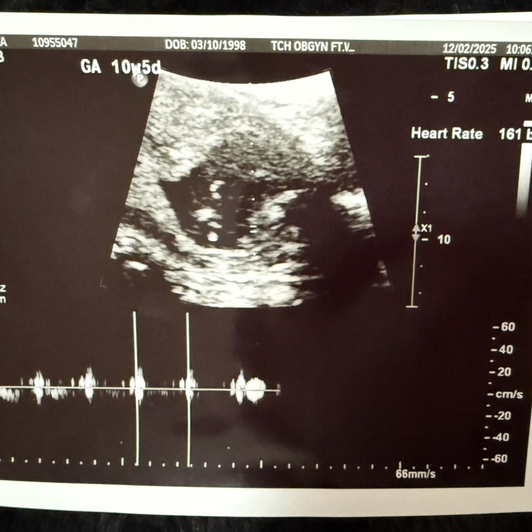 Photo shared by Cassandra for their Babylist baby registry.