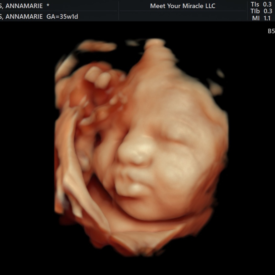 Photo shared by Annamarie for their Babylist baby registry.