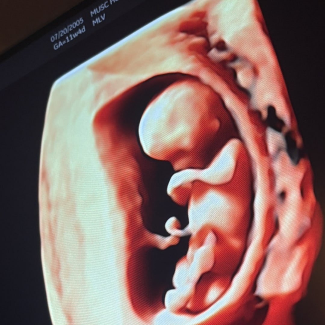 Photo shared by JaNiya for their Babylist baby registry.