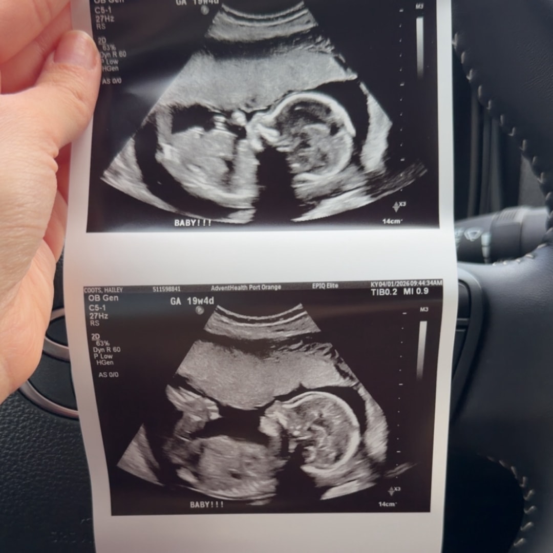 Photo shared by Hailey for their Babylist baby registry.