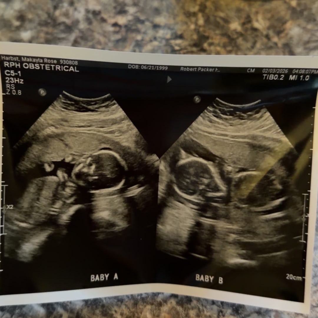 Photo shared by Makayla for their Babylist baby registry.