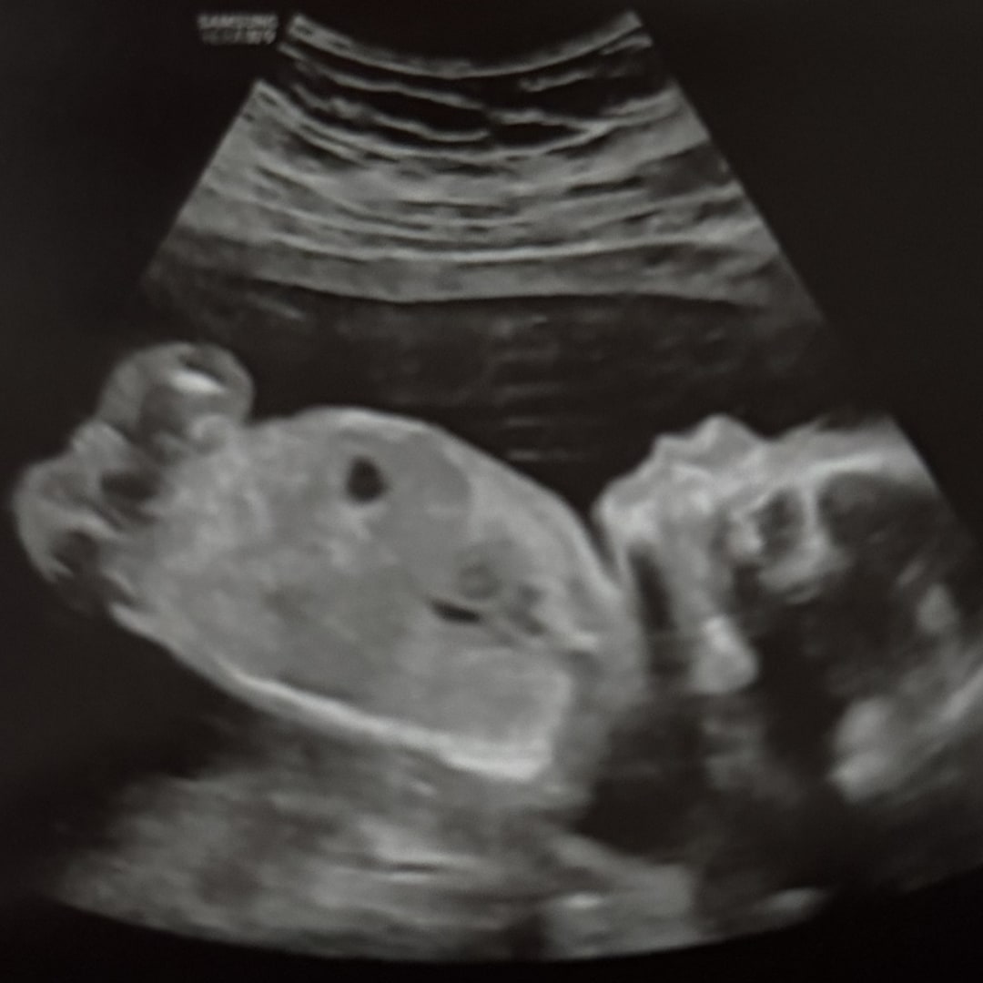 Photo shared by Aelin & Marco for their Babylist baby registry.