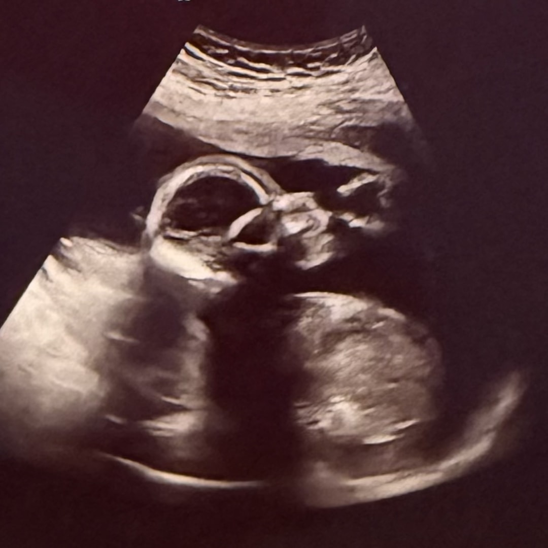 Photo shared by Raegen for their Babylist baby registry.