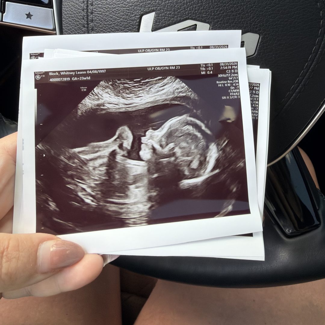 Photo shared by Whitney for their Babylist baby registry.
