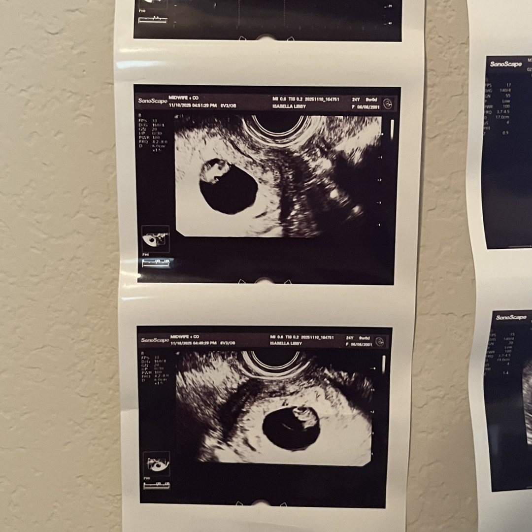 Photo shared by Isabella for their Babylist baby registry.