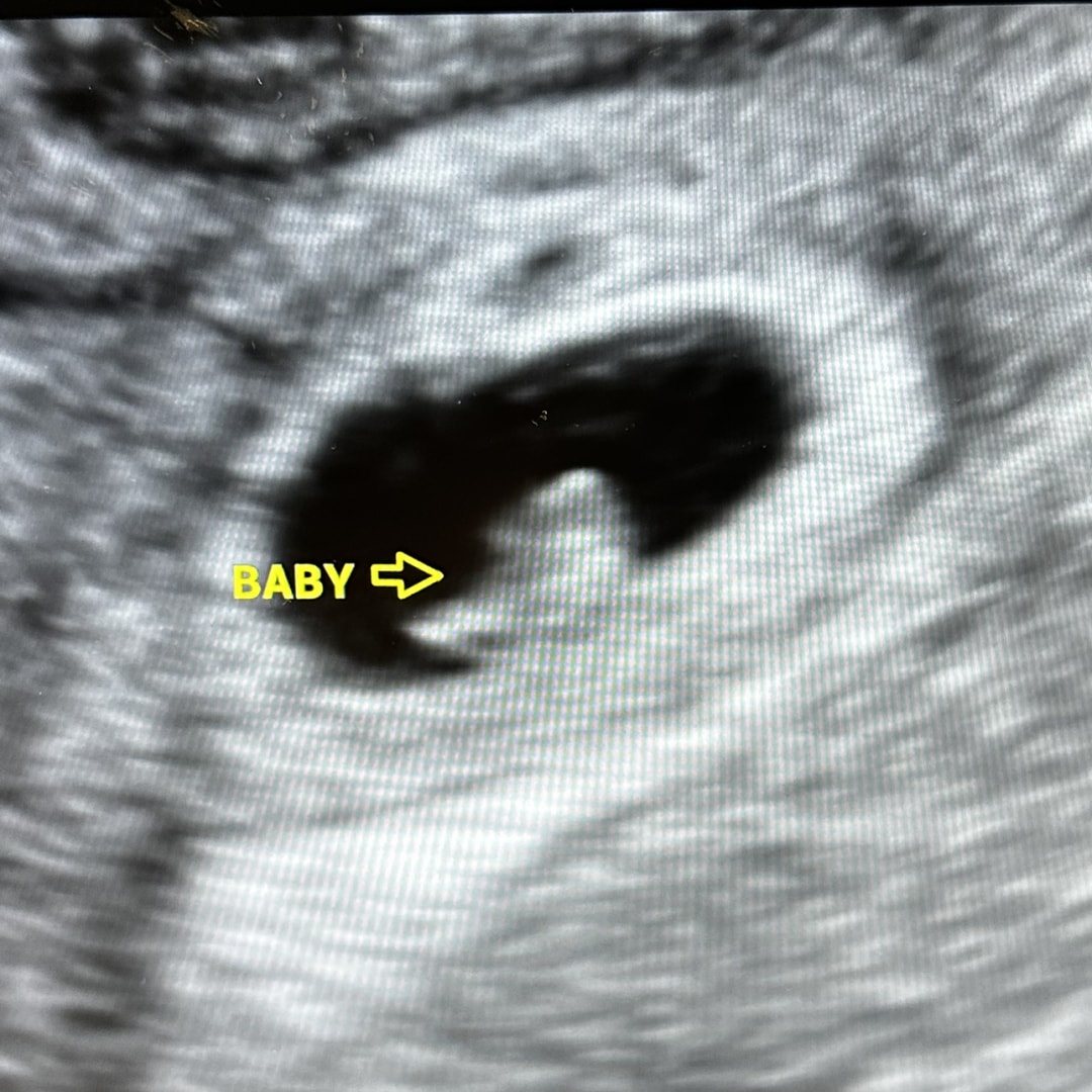 Photo shared by Melissa for their Babylist baby registry.
