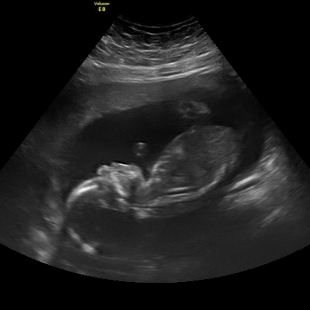 Photo shared by Brenda for their Babylist baby registry.