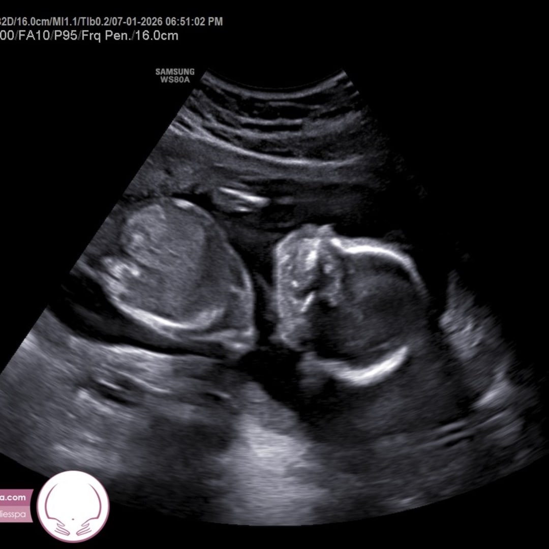 Photo shared by Alexis for their Babylist baby registry.