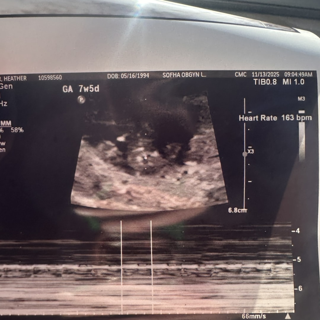 Photo shared by Heather for their Babylist baby registry.