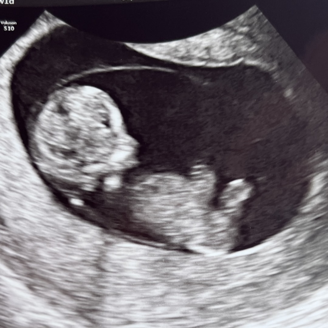 Photo shared by Kaitlyn for their Babylist baby registry.