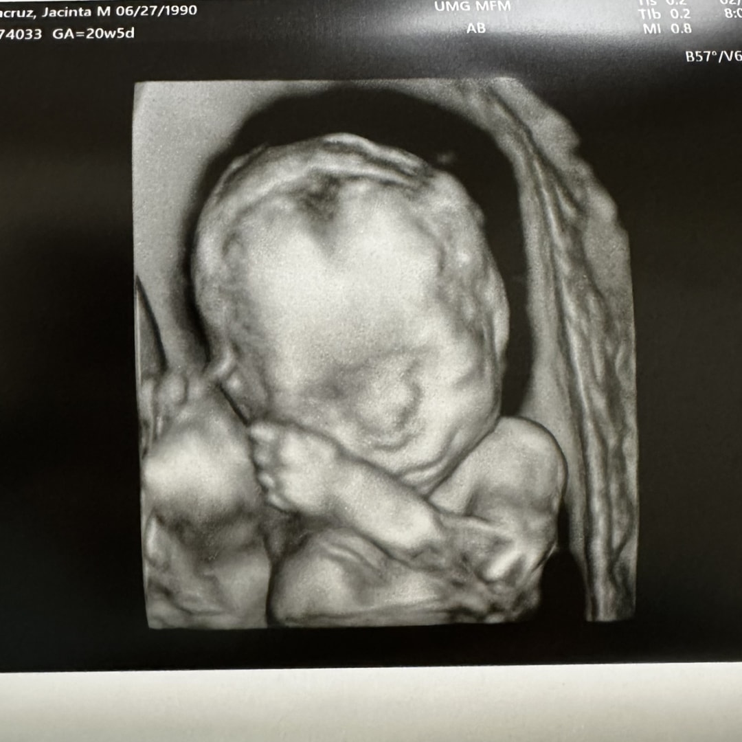 Photo shared by Jacinta for their Babylist baby registry.