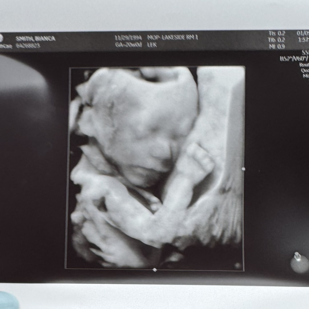 Photo shared by Bianca for their Babylist baby registry.