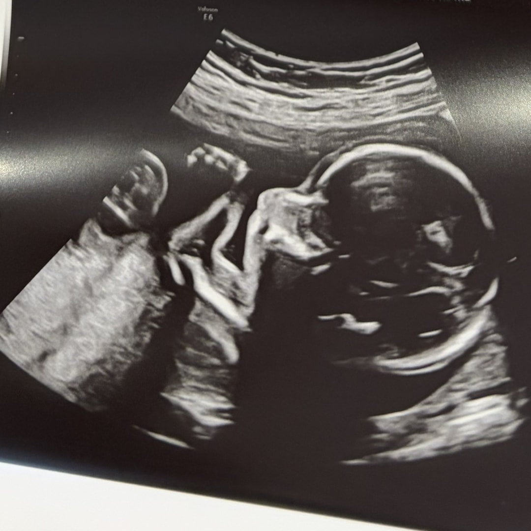 Photo shared by Haley for their Babylist baby registry.