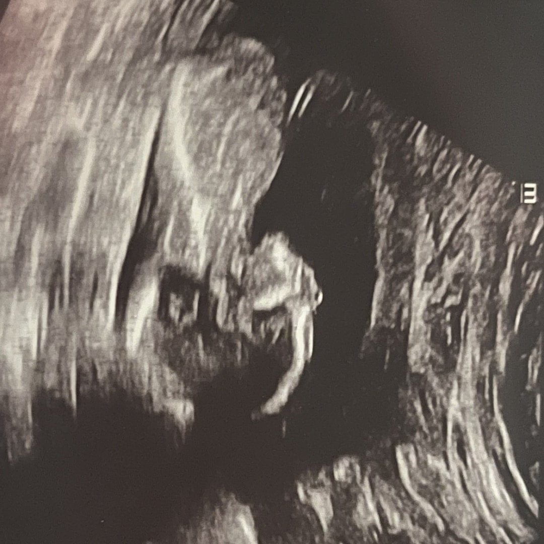 Photo shared by Cali for their Babylist baby registry.