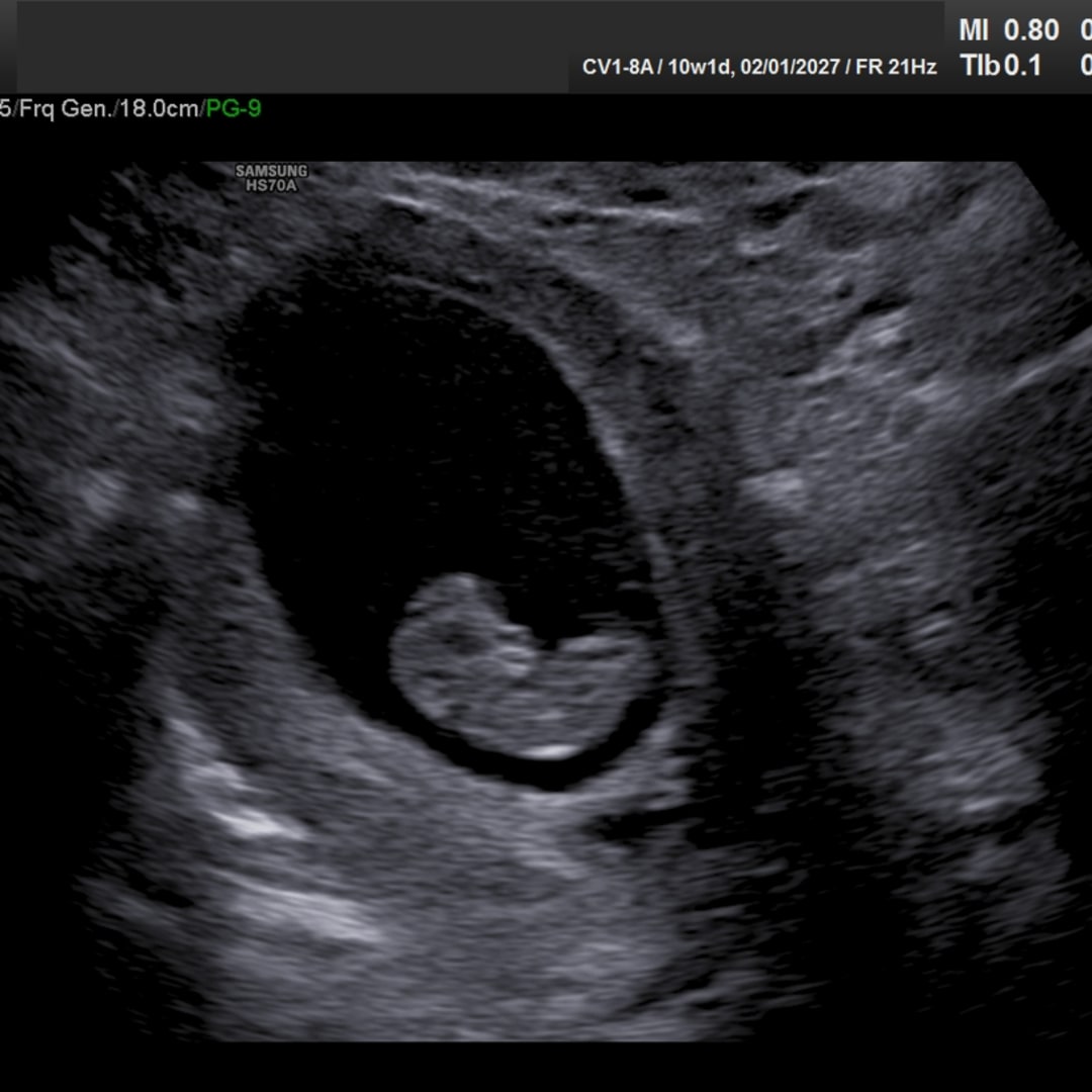 Photo shared by Samantha for their Babylist baby registry.