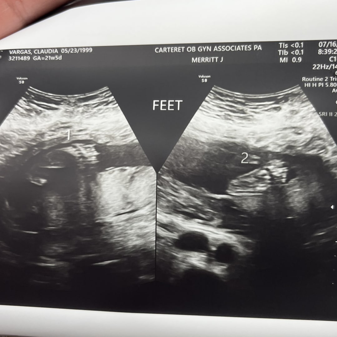 Photo shared by Claudia for their Babylist baby registry.