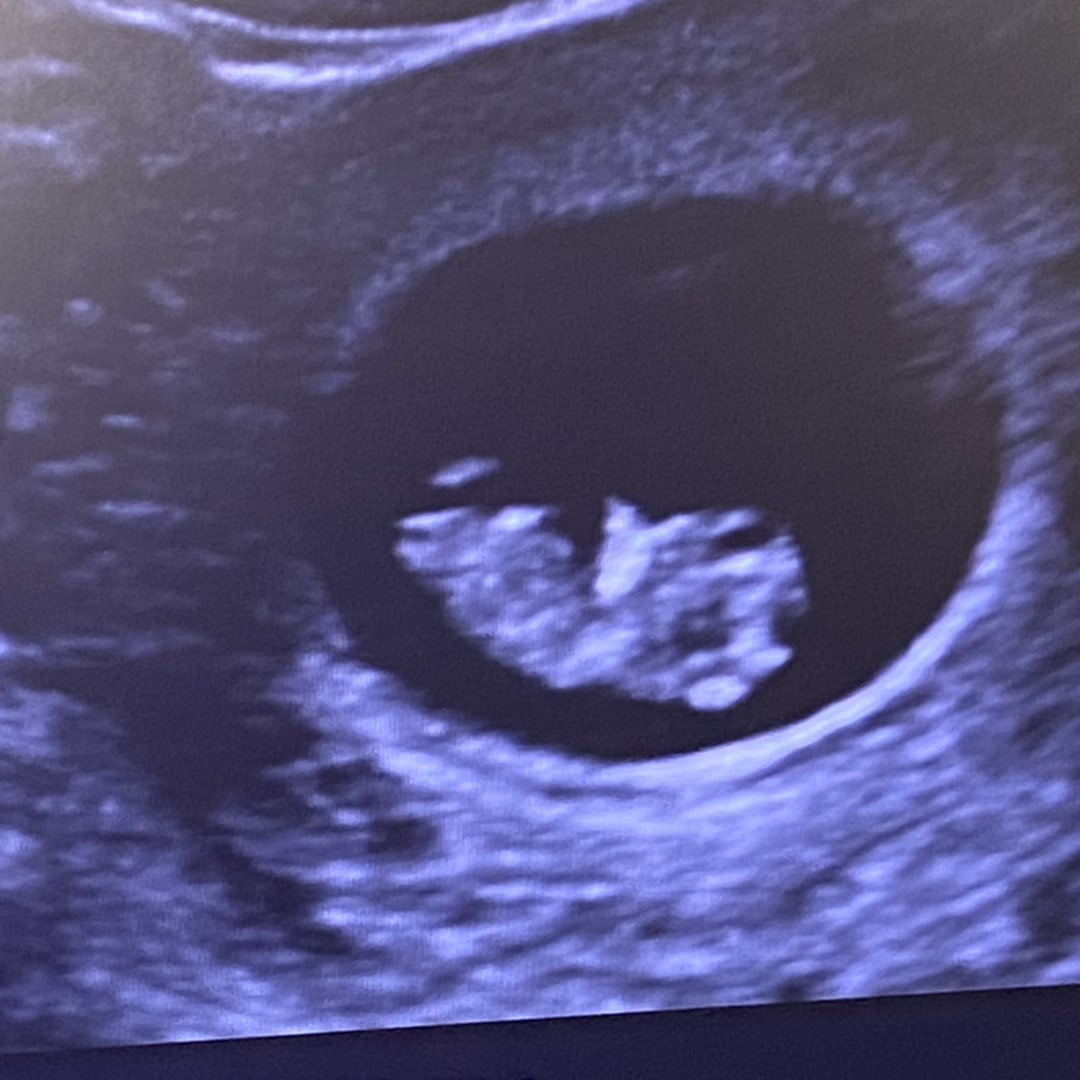 Photo shared by Mary for their Babylist baby registry.