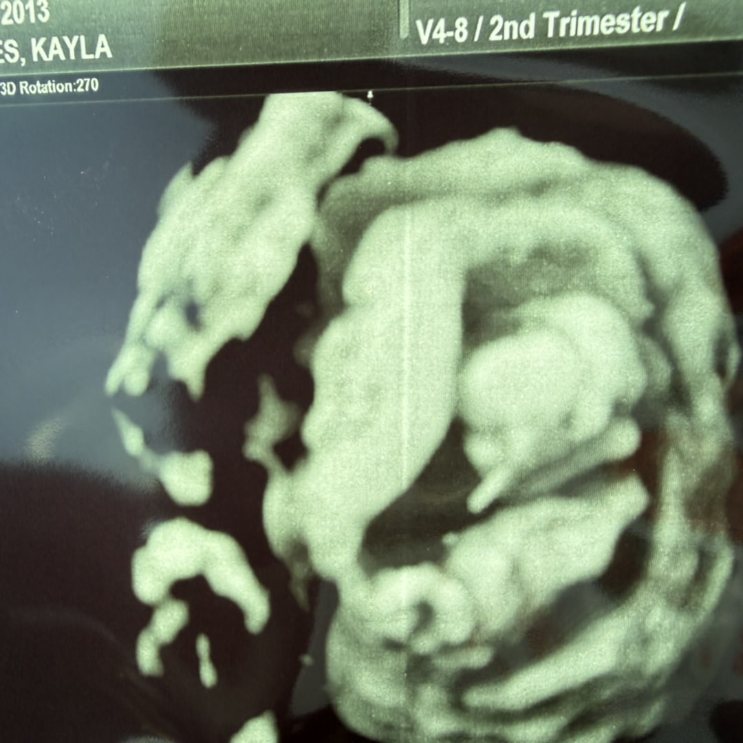 Photo shared by Kayla for their Babylist baby registry.