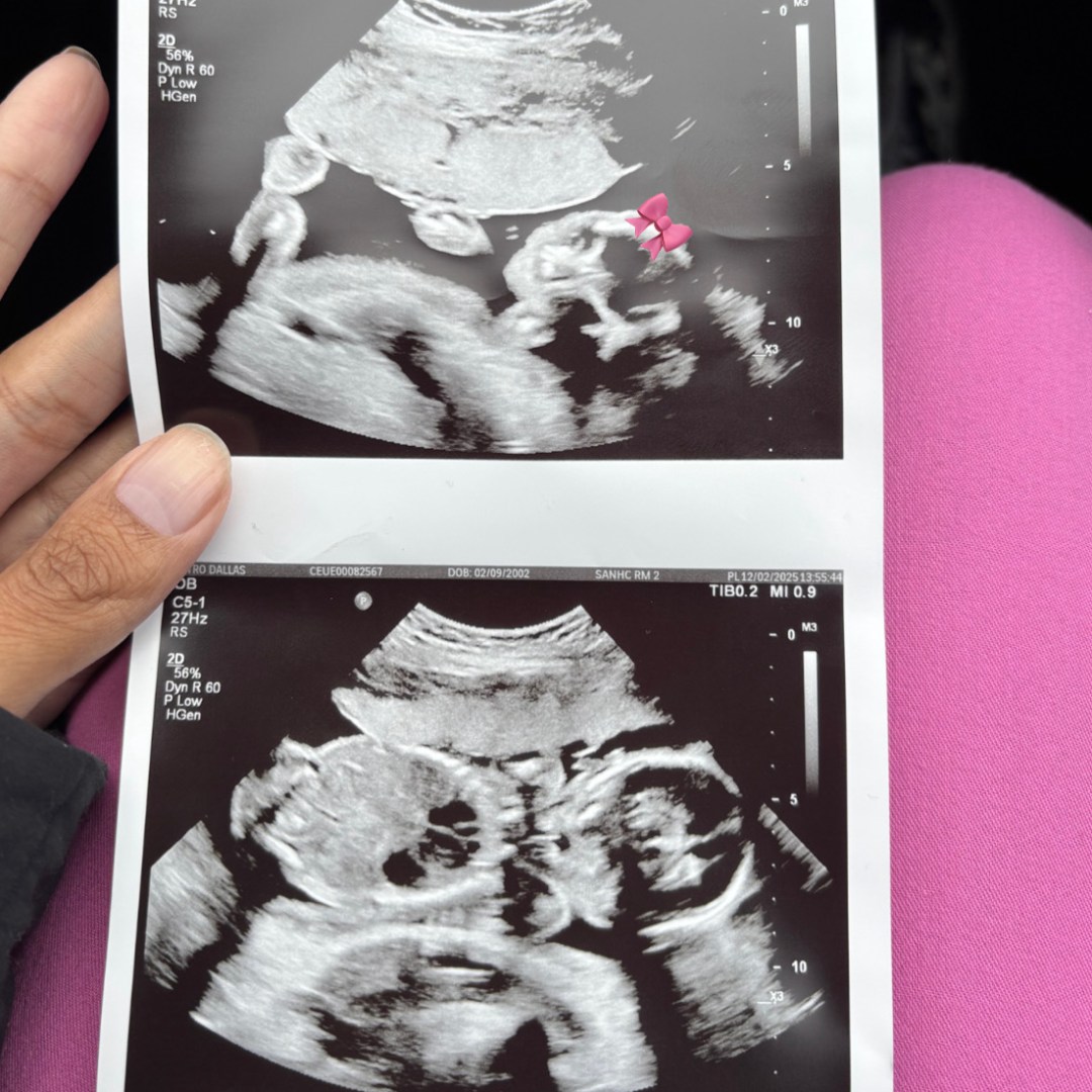 Photo shared by Dallas for their Babylist baby registry.