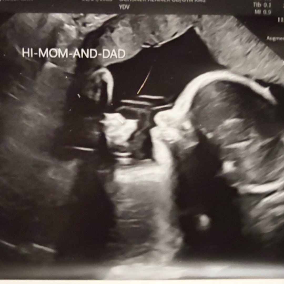 Photo shared by Kelly Ann for their Babylist baby registry.