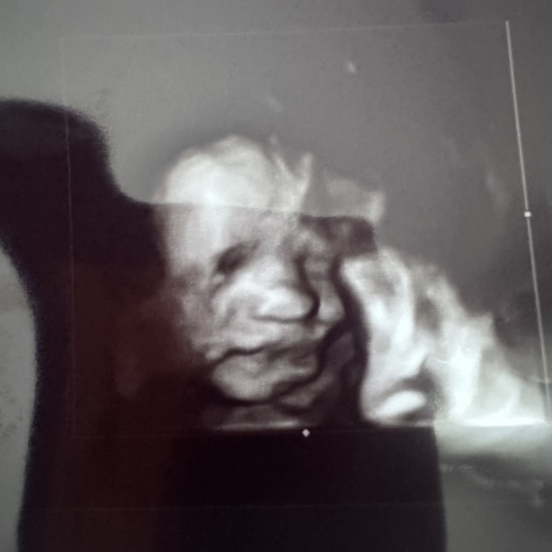 Photo shared by RayeAnne for their Babylist baby registry.