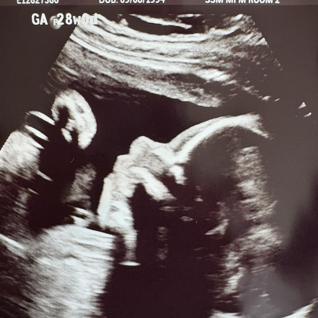 Photo shared by Emily for their Babylist baby registry.