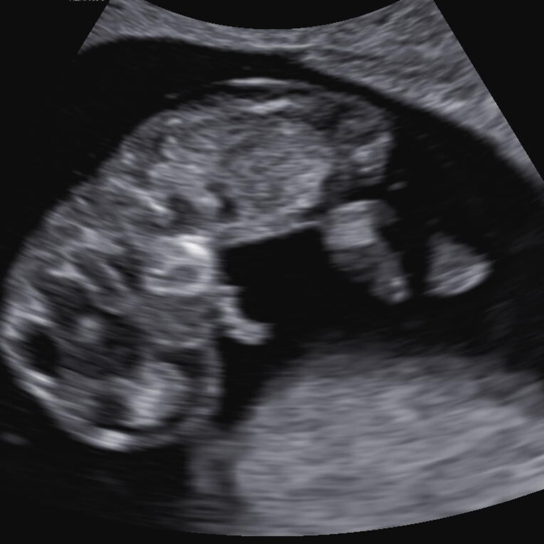 Photo shared by Giovanni for their Babylist baby registry.