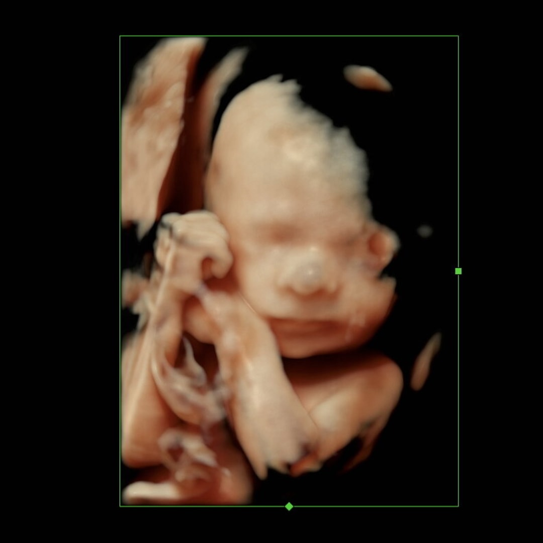 Photo shared by Lindsay for their Babylist baby registry.