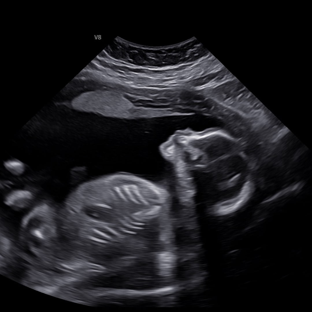Photo shared by Viktorya for their Babylist baby registry.