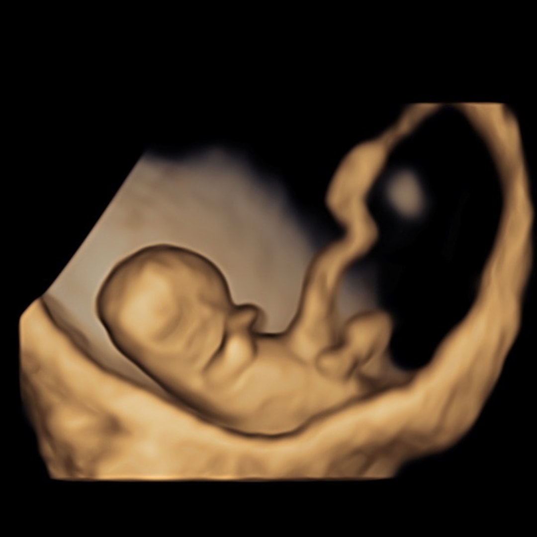 Photo shared by Alexis for their Babylist baby registry.