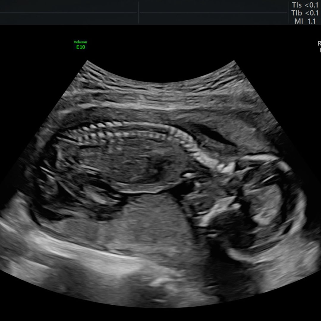 Photo shared by Caroline for their Babylist baby registry.