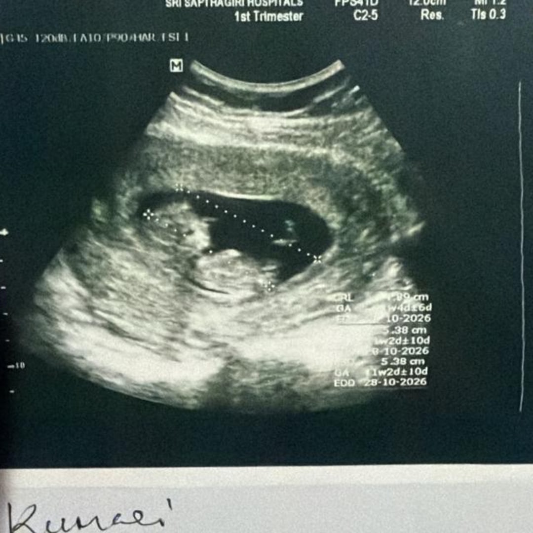 Photo shared by Bhargav for their Babylist baby registry.
