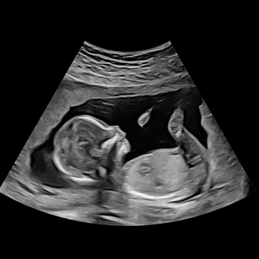 Photo shared by Caroline for their Babylist baby registry.