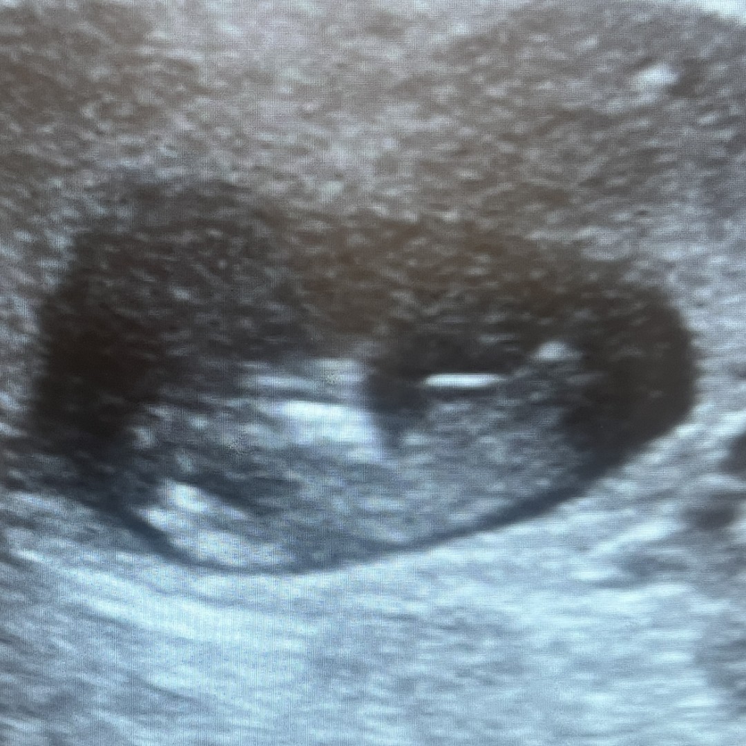 Photo shared by Jessica for their Babylist baby registry.