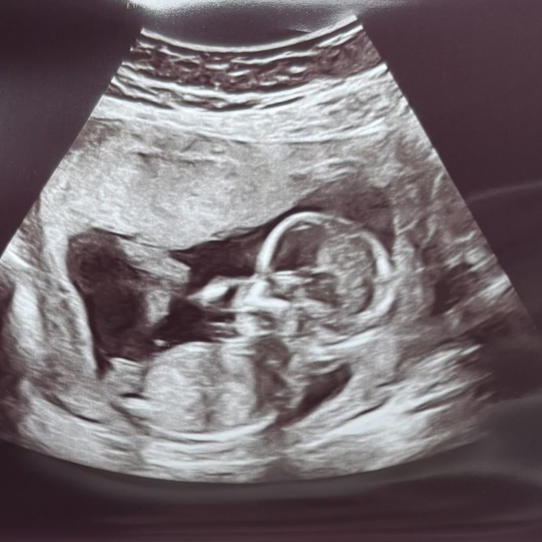 Photo shared by Lauren for their Babylist baby registry.