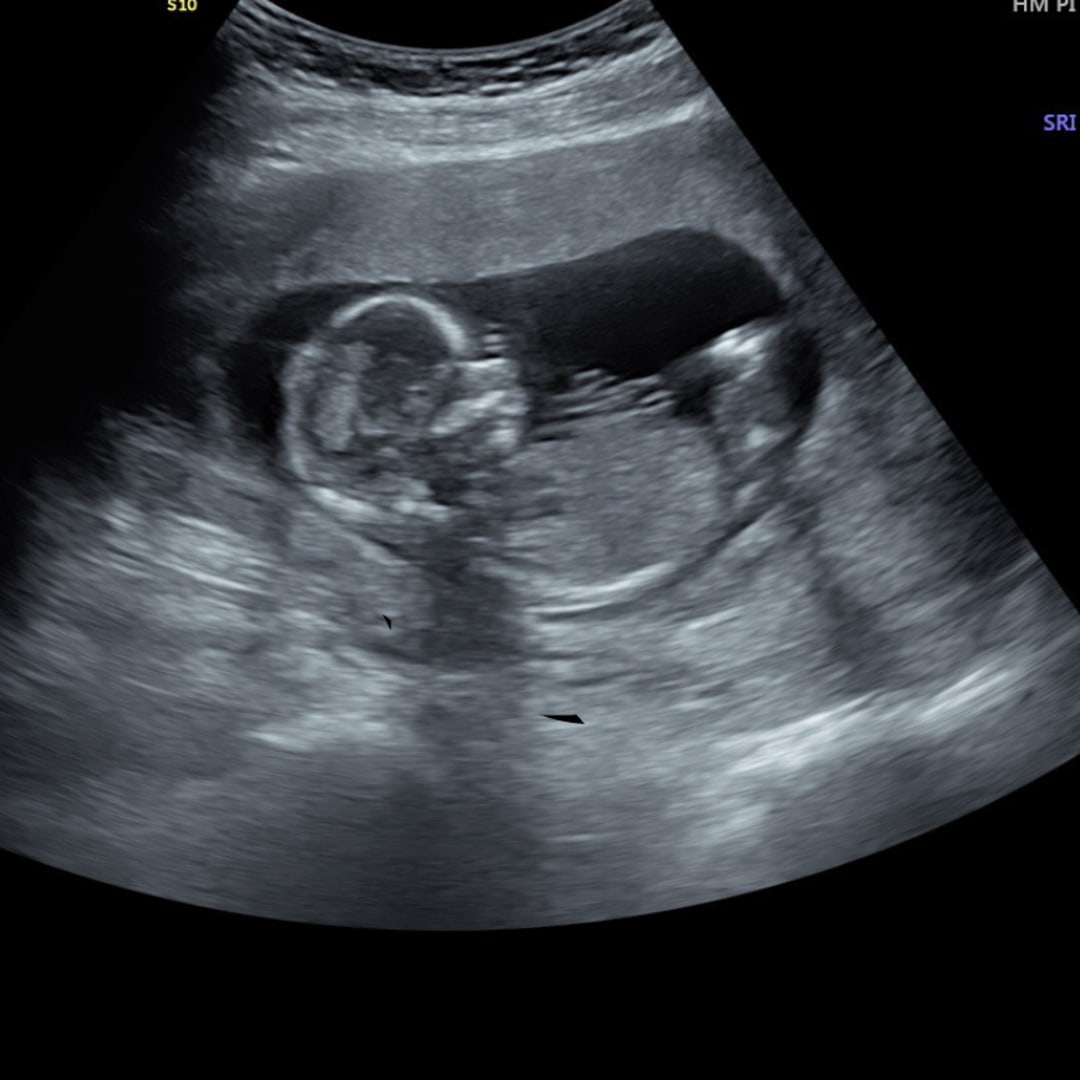 Photo shared by Emma for their Babylist baby registry.