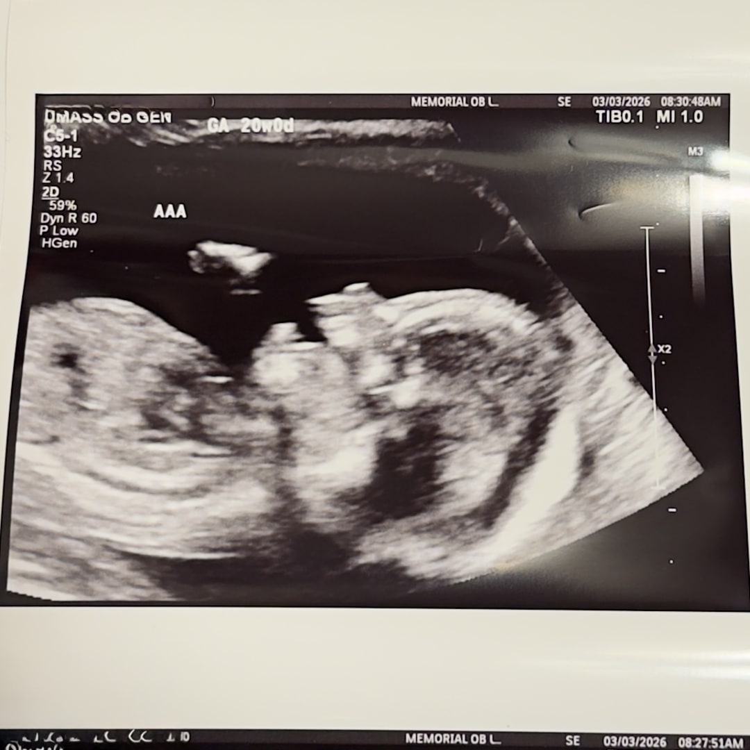 Photo shared by Cassandra for their Babylist baby registry.