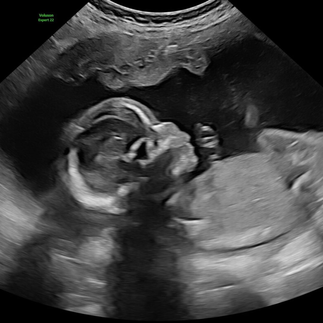 Photo shared by Ashley for their Babylist baby registry.