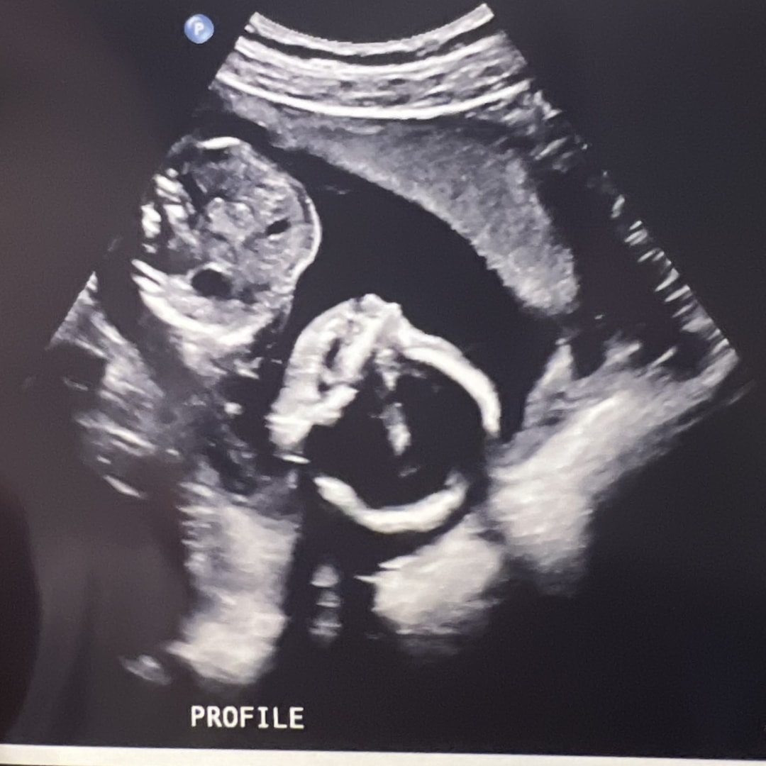 Photo shared by Gabrielle for their Babylist baby registry.